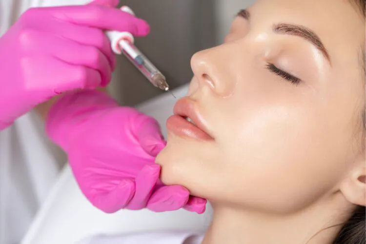 Hyaluronic acid lip filler being injected with precision